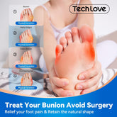 Tech Love MB3 Bunion Corrector for Women and Men Big Toe and Tail Toe Pain Relief. Bunion Socks Wear With Shoes Splint Sleeve Spacer Separator Hammer Toe Corrector for Left and Right Foots. S size 1 Pair